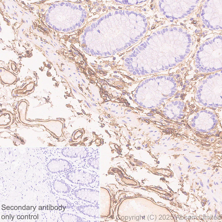 Immunohistochemistry (Formalin/PFA-fixed paraffin-embedded sections) - Anti-EMP-1 antibody [EPR30304-517] (AB325387)