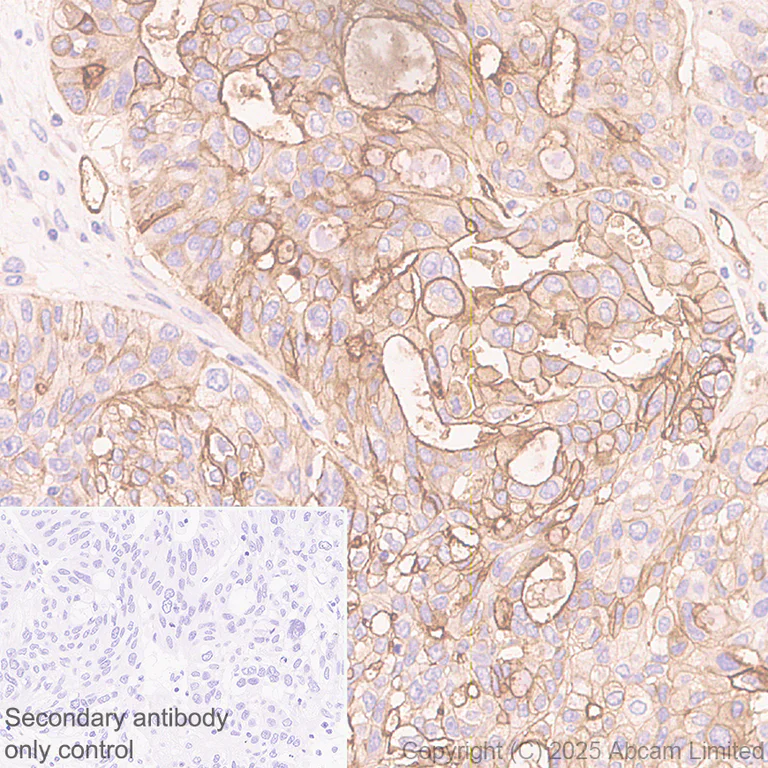 Immunohistochemistry (Formalin/PFA-fixed paraffin-embedded sections) - Anti-EMP-1 antibody [EPR30304-517] (AB325387)