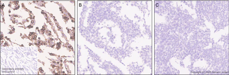 Immunohistochemistry (Formalin/PFA-fixed paraffin-embedded sections) - Anti-EMP-1 antibody [EPR30304-517] (AB325387)
