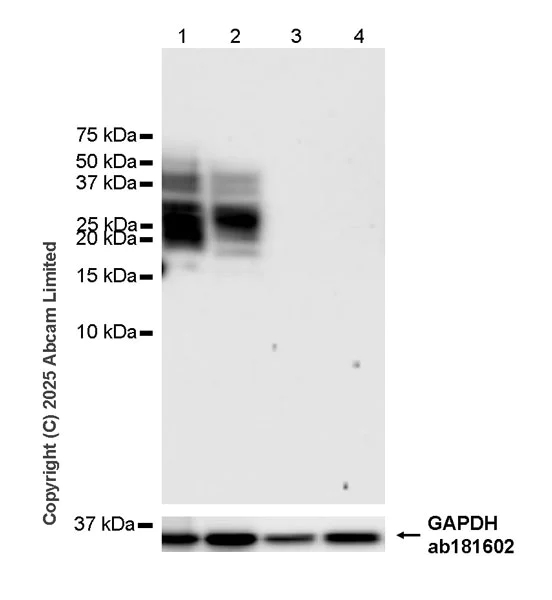 Western blot - Anti-EMP-1 antibody [EPR30304-517] (AB325387)