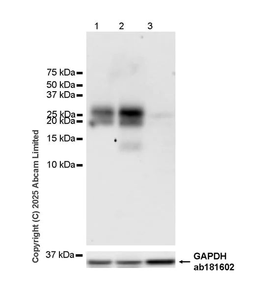 Western blot - Anti-EMP-1 antibody [EPR30304-517] (AB325387)