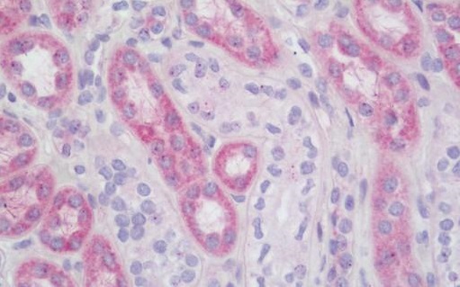 Immunohistochemistry (Formalin/PFA-fixed paraffin-embedded sections) - Anti-EMP-1 antibody - N-terminal (AB230445)