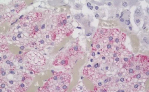 Immunohistochemistry (Formalin/PFA-fixed paraffin-embedded sections) - Anti-EMP-1 antibody - N-terminal (AB230445)