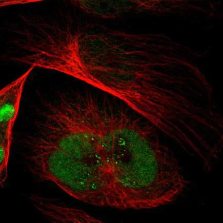 Immunocytochemistry/ Immunofluorescence - Anti-EMP2 antibody (AB223718)