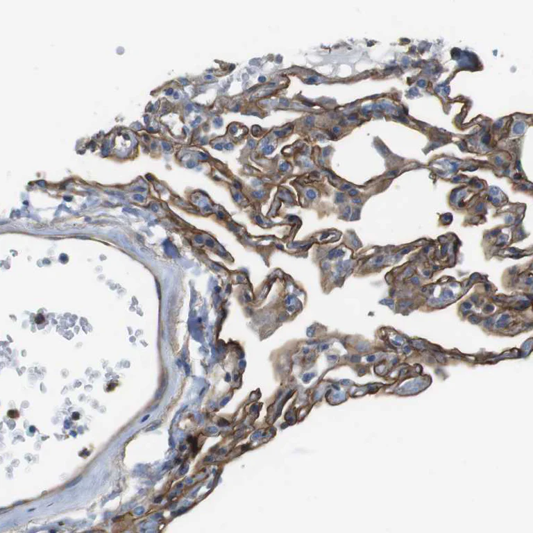 Immunohistochemistry (Formalin/PFA-fixed paraffin-embedded sections) - Anti-EMP2 antibody (AB223718)