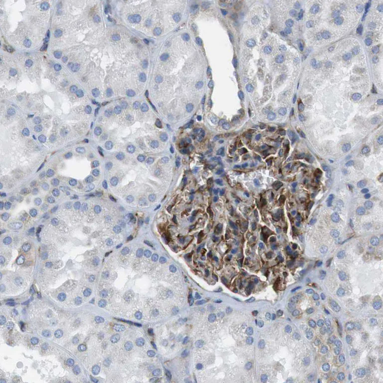 Immunohistochemistry (Formalin/PFA-fixed paraffin-embedded sections) - Anti-EMP2 antibody (AB223718)