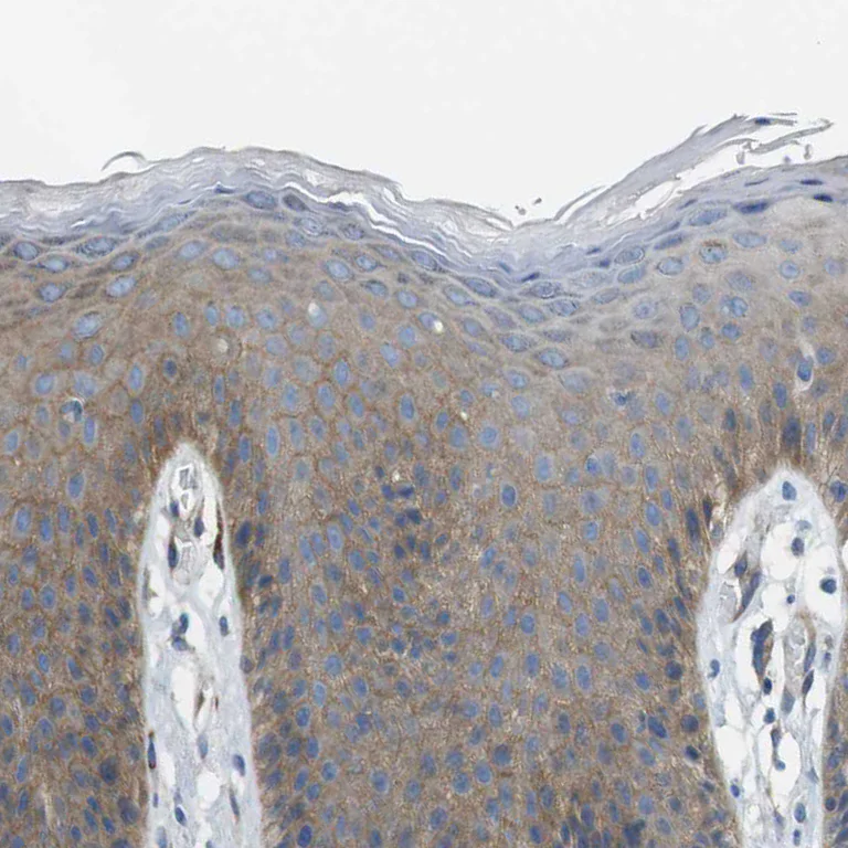 Immunohistochemistry (Formalin/PFA-fixed paraffin-embedded sections) - Anti-EMP2 antibody (AB223718)
