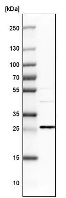 Western blot - Anti-EMP2 antibody (AB223718)