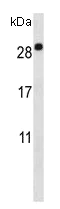 Western blot - Anti-EMP2 antibody - C-terminal (AB174699)