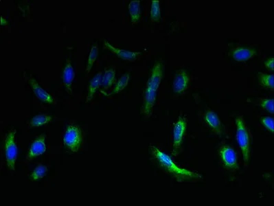 Immunocytochemistry/ Immunofluorescence - Anti-EMP3 antibody (AB236671)