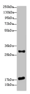 Western blot - Anti-EMP3 antibody (AB236671)