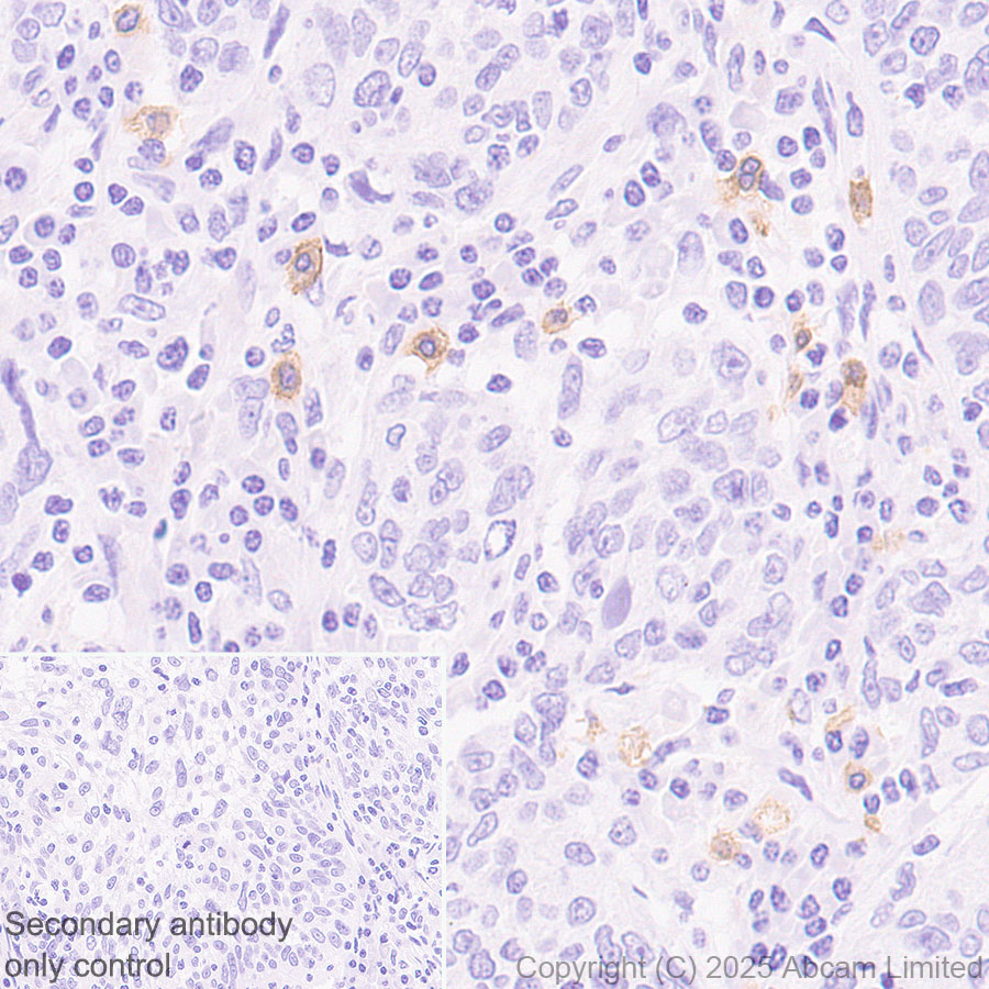 Immunohistochemistry (Formalin/PFA-fixed paraffin-embedded sections) - Anti-EMR1/ADGRE1 (F4/80) antibody [RM1302] (ab323648), expandable thumbnail