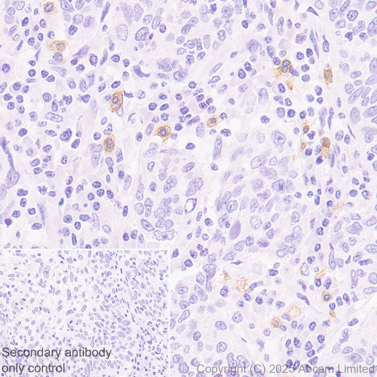 Immunohistochemistry (Formalin/PFA-fixed paraffin-embedded sections) - Anti-EMR1/ADGRE1 (F4/80) antibody [RM1302] (AB323648)