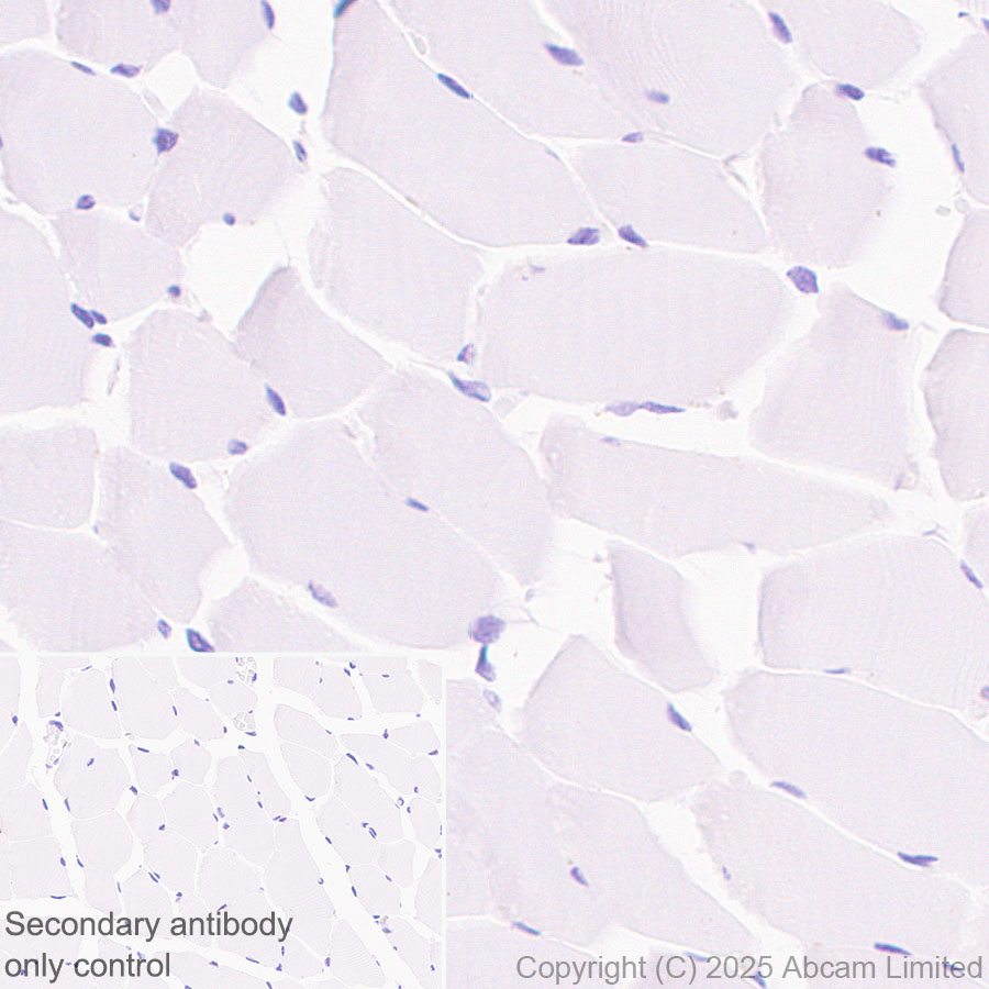 Immunohistochemistry (Formalin/PFA-fixed paraffin-embedded sections) - Anti-EMR1/ADGRE1 (F4/80) antibody [RM1302] (ab323648), expandable thumbnail