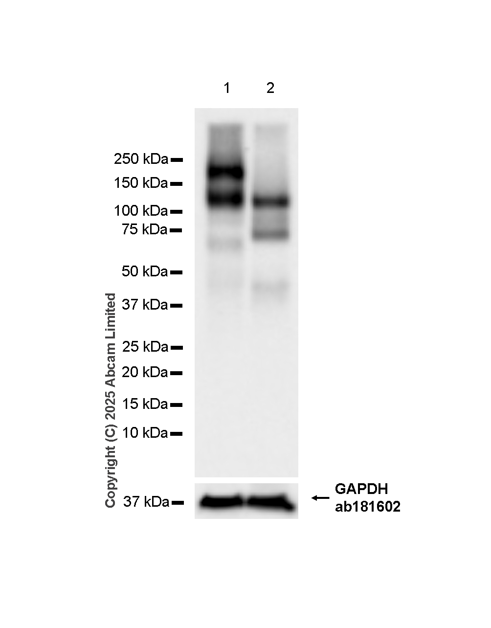 Western blot - Anti-EMR1/ADGRE1 (F4/80) antibody [RM1302] (ab323648), expandable thumbnail