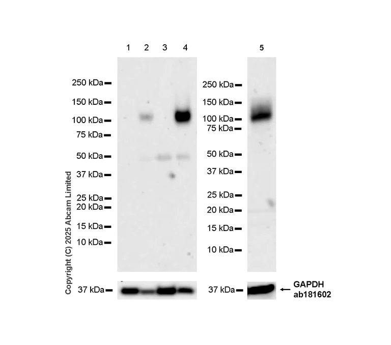 Western blot - Anti-EMR1/ADGRE1 (F4/80) antibody [RM1302] (AB323648)