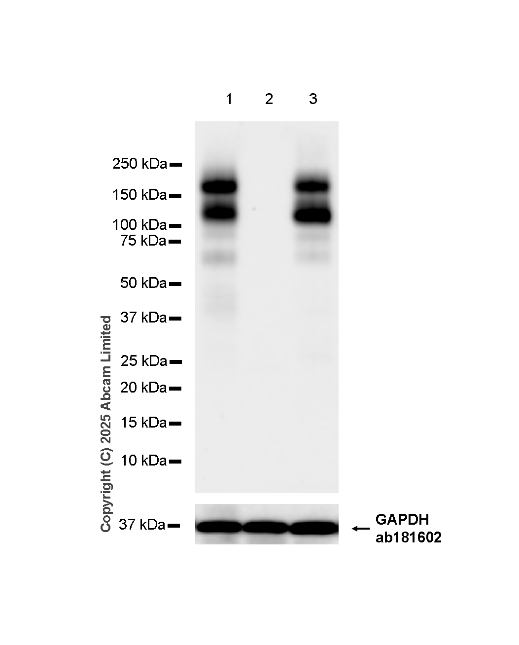 Western blot - Anti-EMR1/ADGRE1 (F4/80) antibody [RM1302] (ab323648), expandable thumbnail