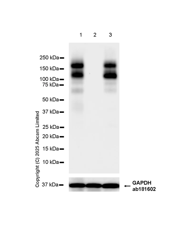 Western blot - Anti-EMR1/ADGRE1 (F4/80) antibody [RM1302] (AB323648)