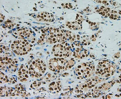 Immunohistochemistry (Formalin/PFA-fixed paraffin-embedded sections) - EMT Marker / Epithelial to Mesenchymal Transition Marker Panel (AB216833)