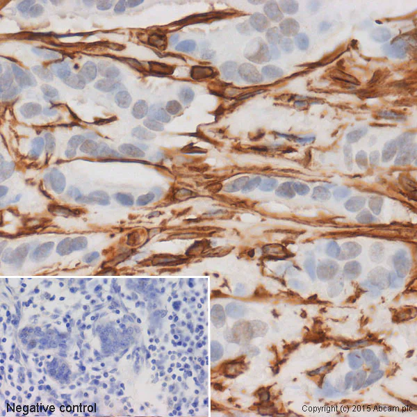 Immunohistochemistry (Formalin/PFA-fixed paraffin-embedded sections) - EMT Marker / Epithelial to Mesenchymal Transition Marker Panel (AB216833)