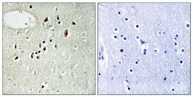 Immunohistochemistry (Formalin/PFA-fixed paraffin-embedded sections) - Anti-EMX2 antibody (AB110112)
