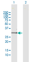 Western blot - Anti-EMX2 antibody (AB171818)