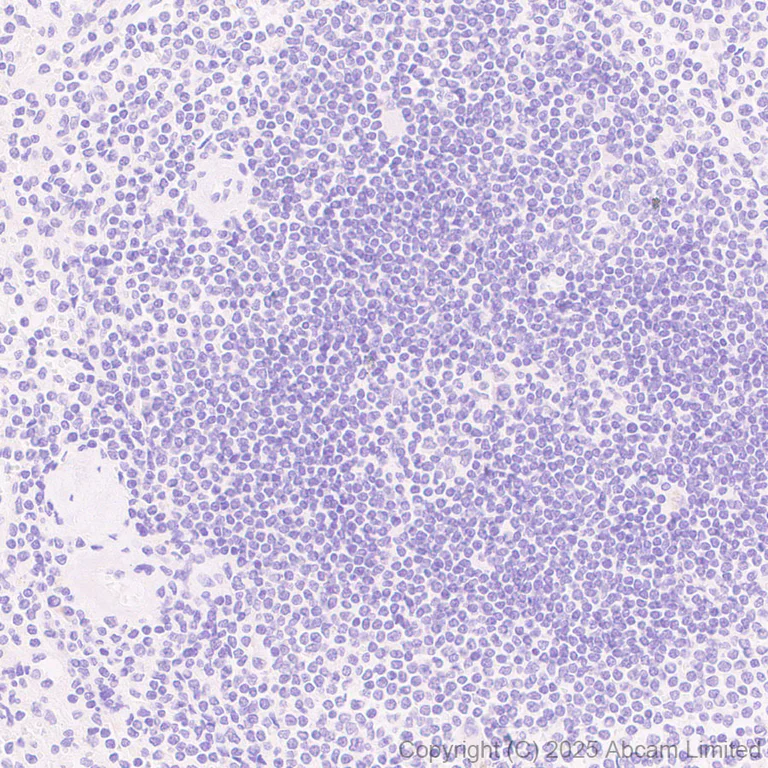 Immunohistochemistry (Formalin/PFA-fixed paraffin-embedded sections) - Anti-EN1 / Engrailed 1 antibody [EPR26667-4] (AB325014)