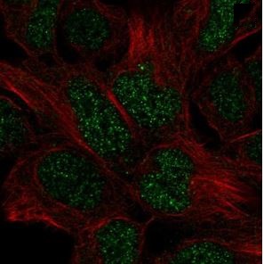 Immunocytochemistry/ Immunofluorescence - Anti-EN2 antibody (AB220058)