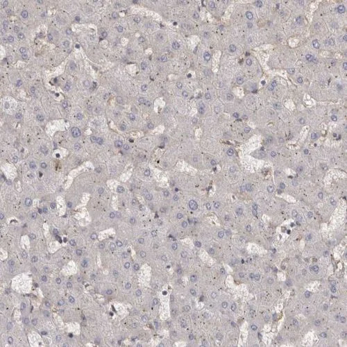 Immunohistochemistry (Formalin/PFA-fixed paraffin-embedded sections) - Anti-ENAH/MENA antibody (AB244417)
