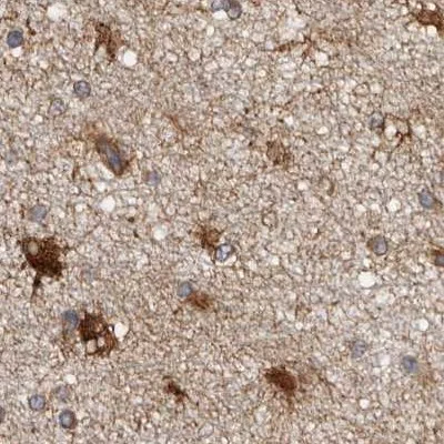 Immunohistochemistry (Formalin/PFA-fixed paraffin-embedded sections) - Anti-ENAH/MENA antibody (AB244417)