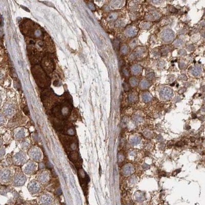 Immunohistochemistry (Formalin/PFA-fixed paraffin-embedded sections) - Anti-ENAH/MENA antibody (AB244417)