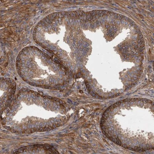 Immunohistochemistry (Formalin/PFA-fixed paraffin-embedded sections) - Anti-ENAH/MENA antibody (AB244417)