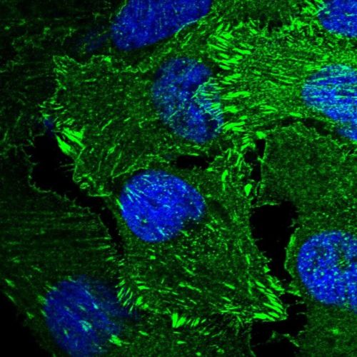 Immunocytochemistry/ Immunofluorescence - Anti-ENAH/MENA antibody (AB244423)