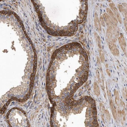 Immunohistochemistry (Formalin/PFA-fixed paraffin-embedded sections) - Anti-ENAH/MENA antibody (AB244423)