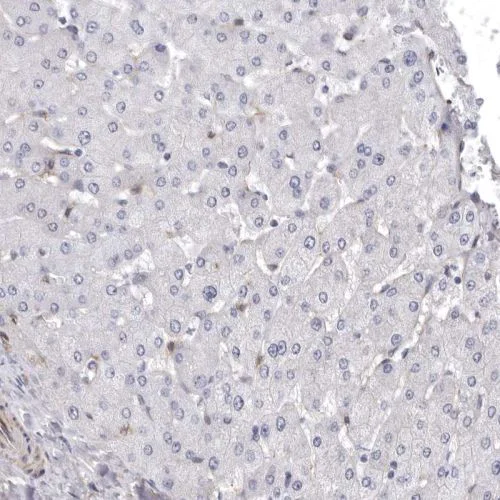Immunohistochemistry (Formalin/PFA-fixed paraffin-embedded sections) - Anti-ENAH/MENA antibody (AB244423)
