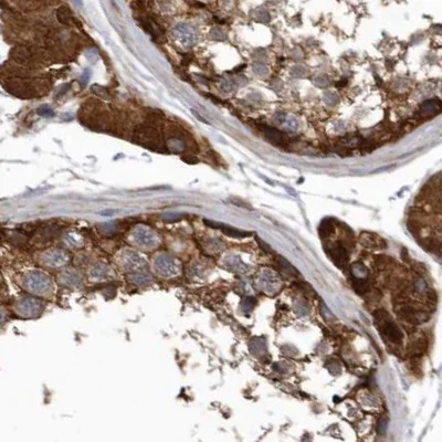 Immunohistochemistry (Formalin/PFA-fixed paraffin-embedded sections) - Anti-ENAH/MENA antibody (AB244423)