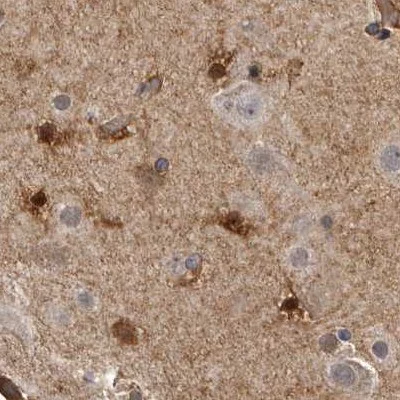 Immunohistochemistry (Formalin/PFA-fixed paraffin-embedded sections) - Anti-ENAH/MENA antibody (AB244423)