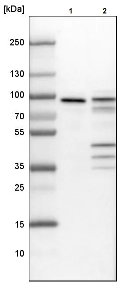 Western blot - Anti-ENAH/MENA antibody (AB244423)