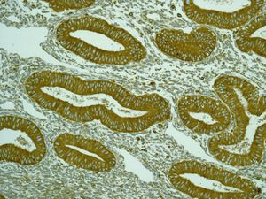 Immunohistochemistry (Formalin/PFA-fixed paraffin-embedded sections) - Anti-ENAH/MENA antibody [EPR5660] - BSA and Azide free (AB247959)