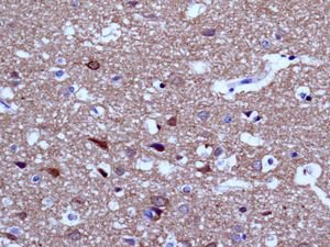 Immunohistochemistry (Formalin/PFA-fixed paraffin-embedded sections) - Anti-ENC1 antibody [EPR5406(B)] (AB124902)