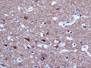 Immunohistochemistry (Formalin/PFA-fixed paraffin-embedded sections) - Anti-ENC1 antibody [EPR5406(B)] (AB124902)