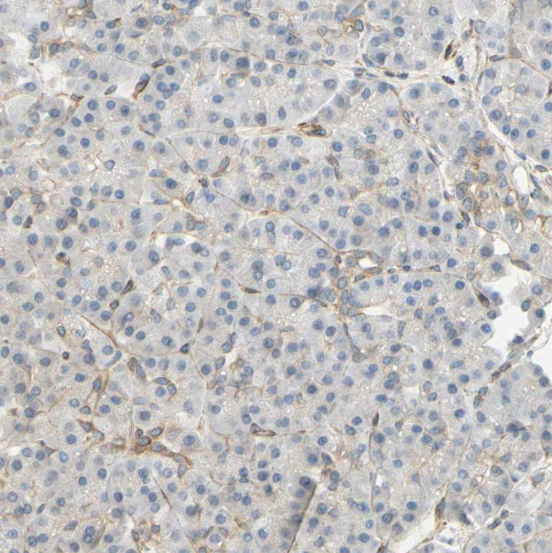 Immunohistochemistry (Formalin/PFA-fixed paraffin-embedded sections) - Anti-ENDOD1 antibody (AB121293), expandable thumbnail