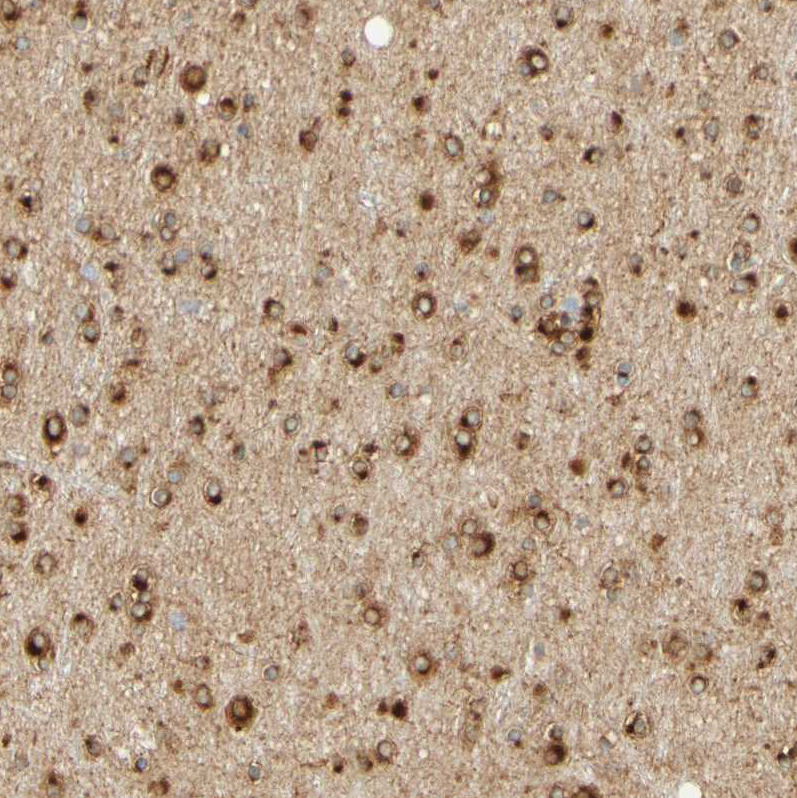 Immunohistochemistry (Formalin/PFA-fixed paraffin-embedded sections) - Anti-ENDOD1 antibody (AB121293), expandable thumbnail