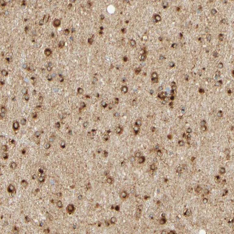 Immunohistochemistry (Formalin/PFA-fixed paraffin-embedded sections) - Anti-ENDOD1 antibody (AB121293)