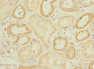 Immunohistochemistry (Formalin/PFA-fixed paraffin-embedded sections) - Anti-Endomucin antibody (AB230018)