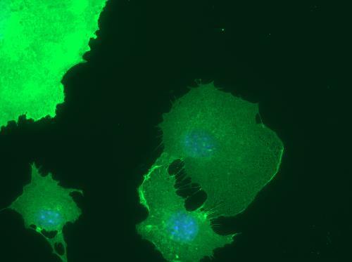 Immunocytochemistry/ Immunofluorescence - Anti-Endomucin antibody [V.7C7.1] (AB106100), expandable thumbnail