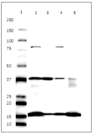 Western blot - Endoplasmic Reticulum Fraction Western Blot Cocktail (AB139415)