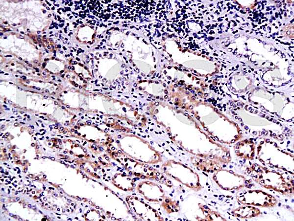 Immunohistochemistry (Formalin/PFA-fixed paraffin-embedded sections) - Anti-Endostatin/COL18A1 antibody (AB202973)