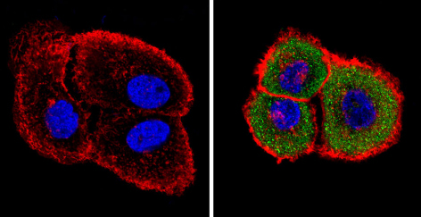 Immunocytochemistry/ Immunofluorescence - Anti-Endostatin/COL18A1 antibody (AB3453), expandable thumbnail