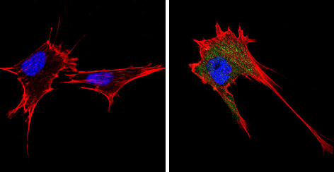 Immunocytochemistry/ Immunofluorescence - Anti-Endostatin/COL18A1 antibody (AB3453), expandable thumbnail
